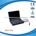 Full Digital laptop ultrasound machine MSLPU02-M